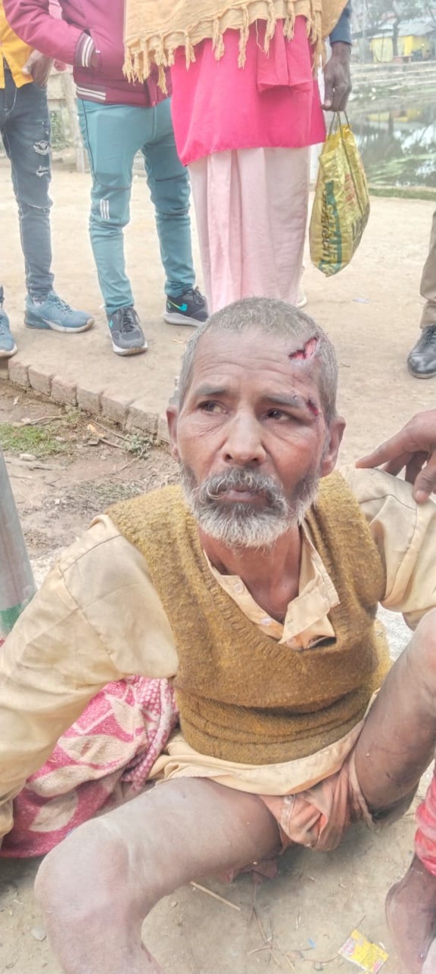 बीती रात अभरन सरोवर के पास अज्ञात व्यक्तियों में श्रद्धालु को पीट कर लहुलुहान किया मंगलवार को सूचना पर पहुंची पुलिस ने पीड़ित को उपचार के लिए संयुक्त चिकित्सालय सिरौलीगौसपुर में भर्ती कराया जिसे जिला अस्पताल रेफर- किया गया