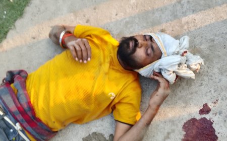 श्रीकोटवाधाम के अभरन सरोवर पर श्रद्धालुओं को टीका लगाने को लेकर भाई व पटीदार ने युवक को जमकर पीटा जिला अस्पताल रेफर-