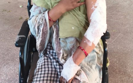 चूल्हे की चिंगारी से निकली आग ने एक छप्परनुमा मकान को जलाकर नष्ट कर दिया