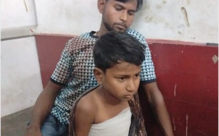 पंपिंगसेट के इंजन में फंसी शर्ट, 12 वर्षीय बालक गंभीर घायल