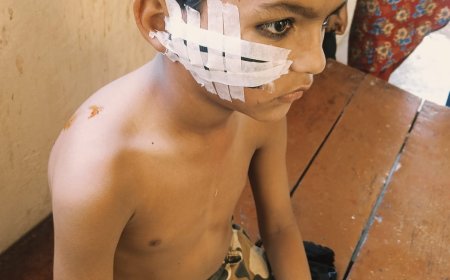 बेलहरा में बंदरों का आतंक, 8 वर्षीय बच्चे पर हमला