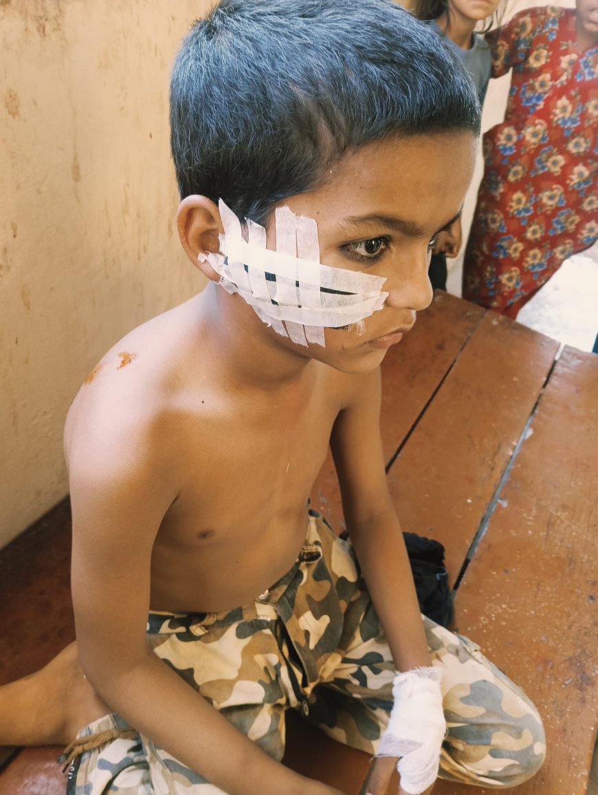 बेलहरा में बंदरों का आतंक, 8 वर्षीय बच्चे पर हमला