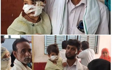 आवारा कुत्ते के हमले में मासूम गंभीर घायल  चेहरे पर 40 टांके, जिला अस्पताल रेफर