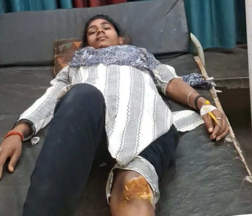 कुत्ते को बचाने में बाइक अनियंत्रित, भाई-बहन गंभीर घायल