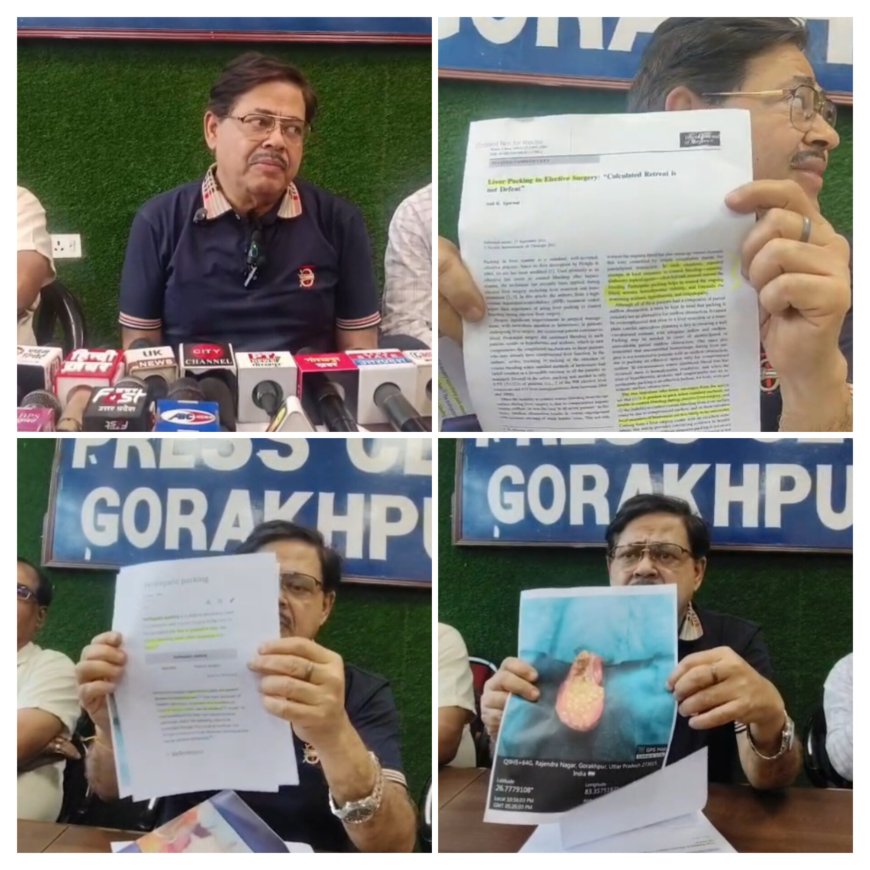 ऑपरेशन के दौरान मौत मामले में डॉक्टर आनंद अग्रवाल की सफाई, बोले— ‘प्रक्रिया के तहत डाला गया था स्पंज, लापरवाही नहीं’