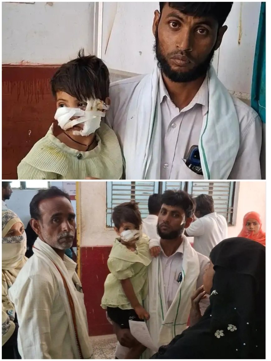 आवारा कुत्ते के हमले में मासूम गंभीर घायल  चेहरे पर 40 टांके, जिला अस्पताल रेफर