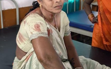 टिकैतनगर CHC के सामने सड़क हादसा