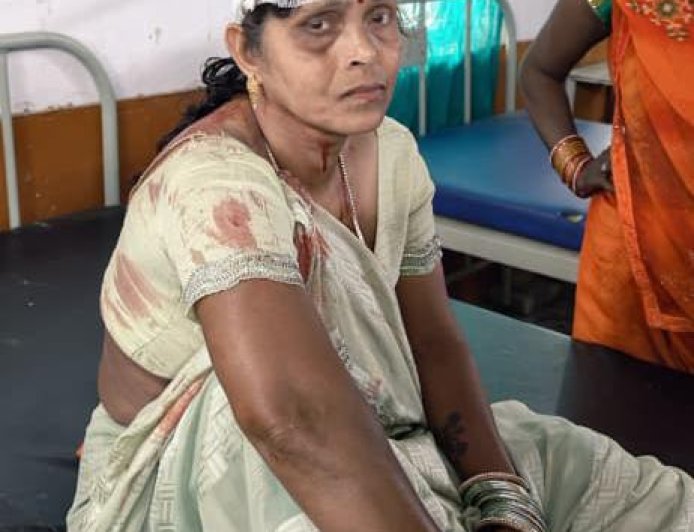 टिकैतनगर CHC के सामने सड़क हादसा