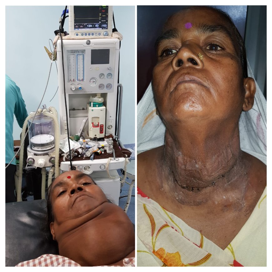 आनंदलोक हॉस्पिटल में जटिल ‘घेघा’ सर्जरी सफल, 50 वर्षीय महिला को मिली नई जिंदगी