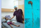 गोरखपुर: 7 वर्षीय बच्ची के पेट से निकला बालों का विशाल गुच्छा, सफल सर्जरी से बची जान