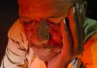 यातायात पुलिस द्वारा घायल को तत्काल जिला अस्पताल पहुंचाया गया