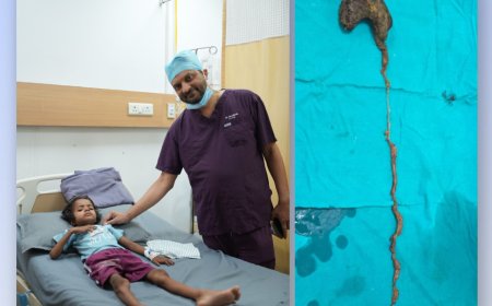 गोरखपुर: 7 वर्षीय बच्ची के पेट से निकला बालों का विशाल गुच्छा, सफल सर्जरी से बची जान