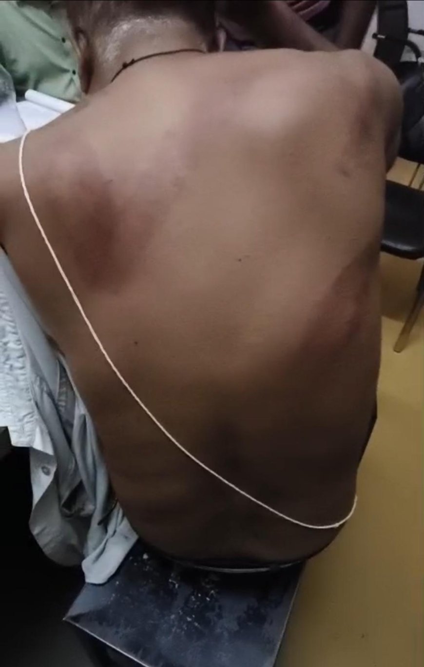 अधिवक्ता की पिटाई का कोतवाली बदोसरांय में मुकदमा दर्ज
